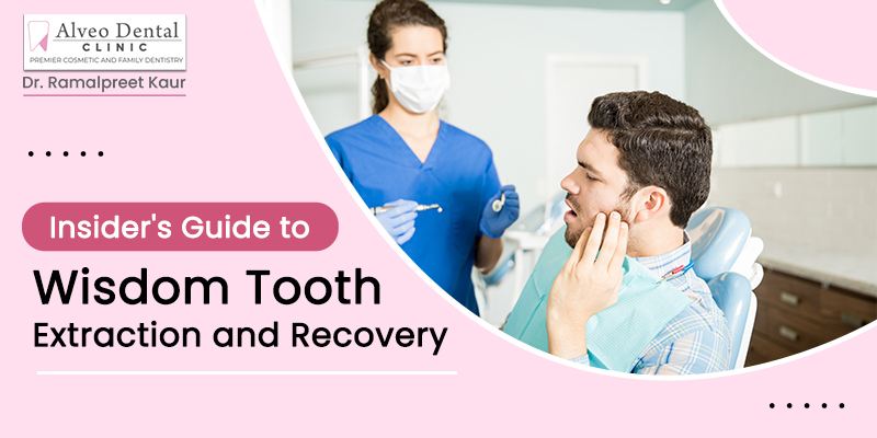 wisdom tooth extraction in gurgaon
