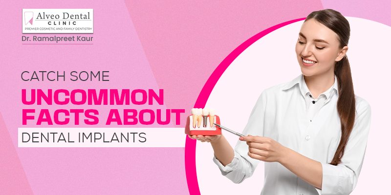 Catch Some Uncommon Facts About Dental Implants